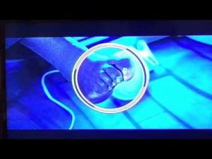 shaq shows bad feet toes on nba
