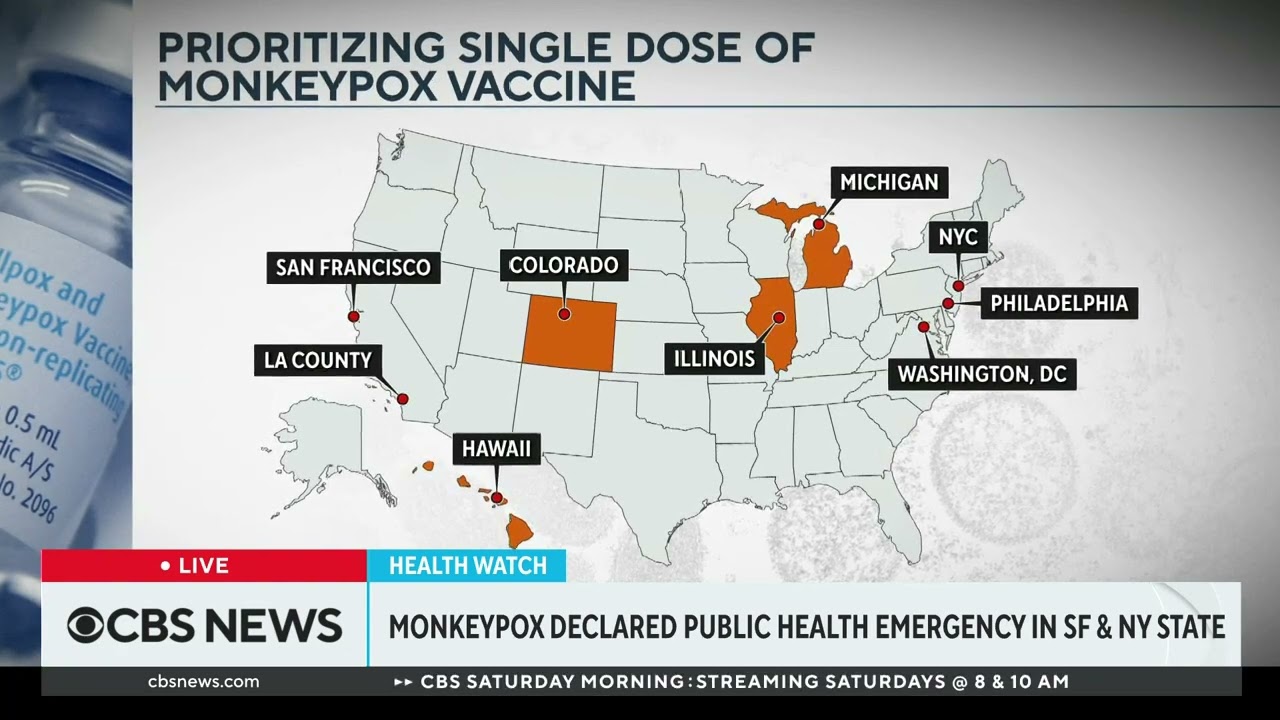 Cbs News: Monkeypox Stirs Health Crises In New York State, San Francisco (07 29 2022)