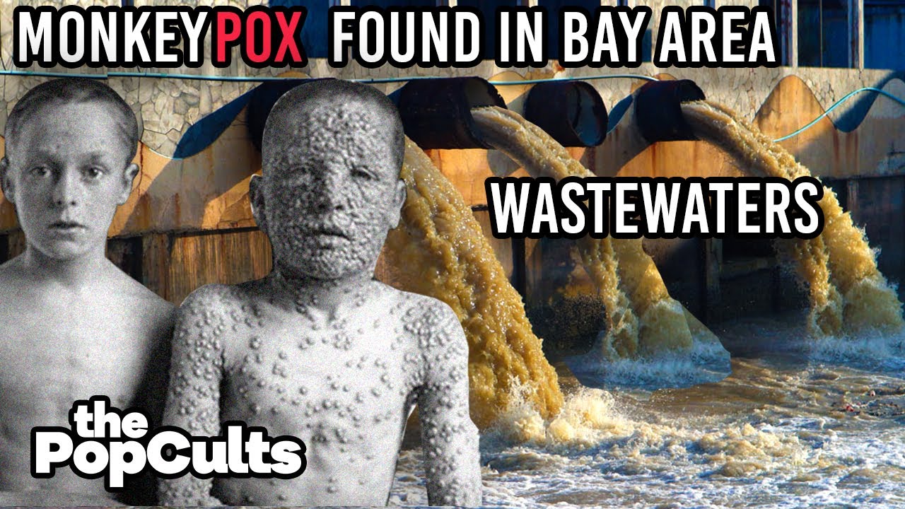 Monkeypox Found In San Francisco Bay Area Wastewater