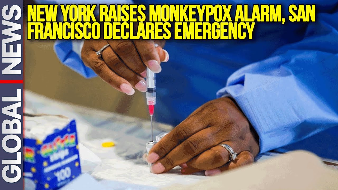 New York Raises Monkeypox Alarm, San Francisco Declares Emergency