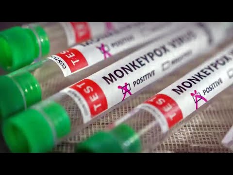 South Bay Monkeypox Cases Grow, Sc County Awaits 700 Doses Of Vaccine