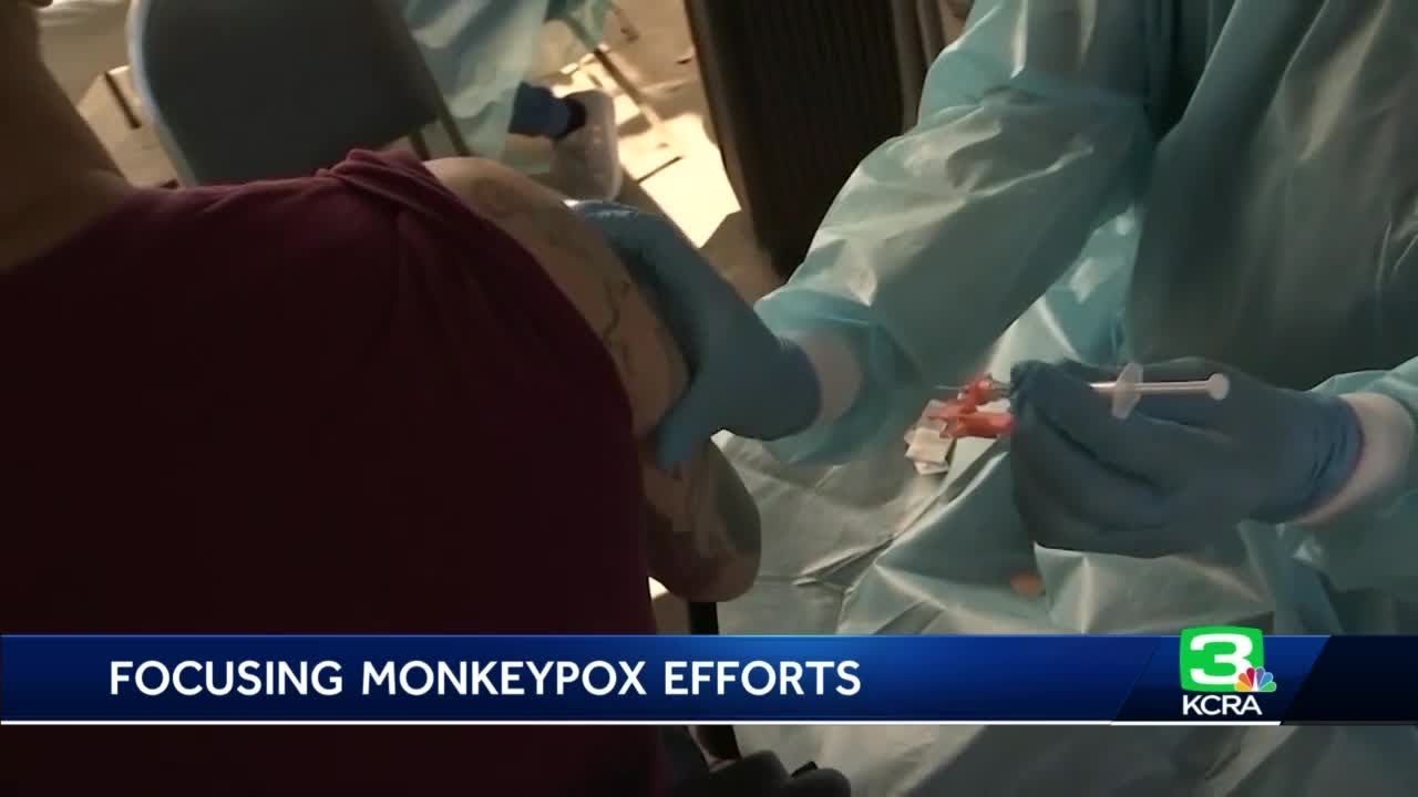 California’s Monkeypox Vaccine Supply Running Out As Demand Increases