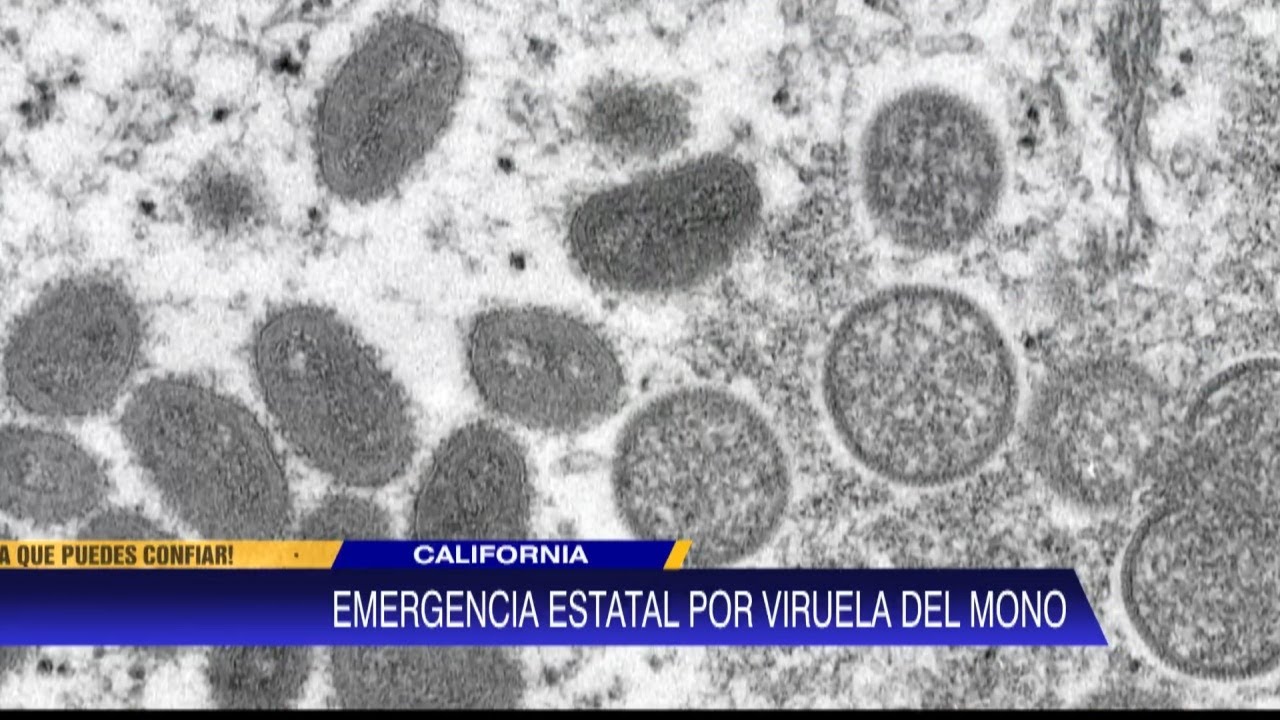 Gobernador De California Declara Un Estado De Emergencia Por La Viruela De Mono