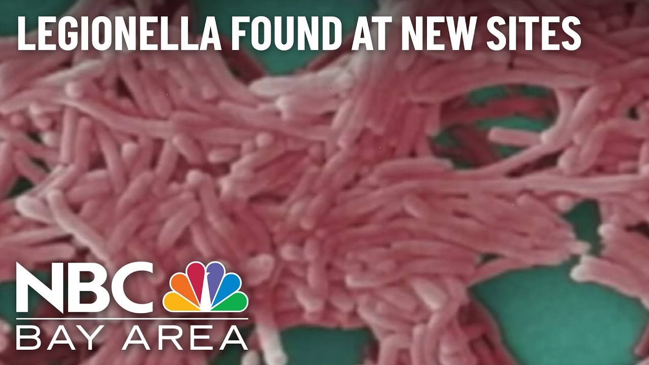 Legionnaires’ Disease Outbreak Traced To Two More Sites In Napa County