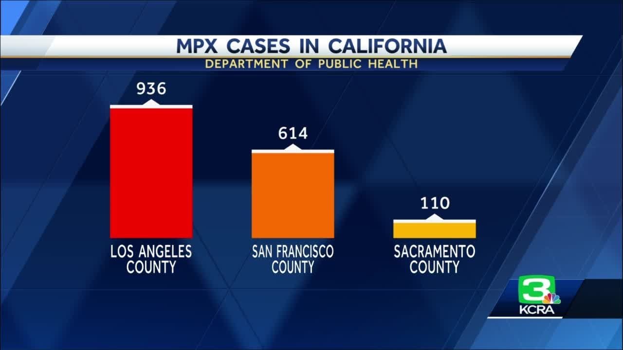 Monkeypox Cases In California