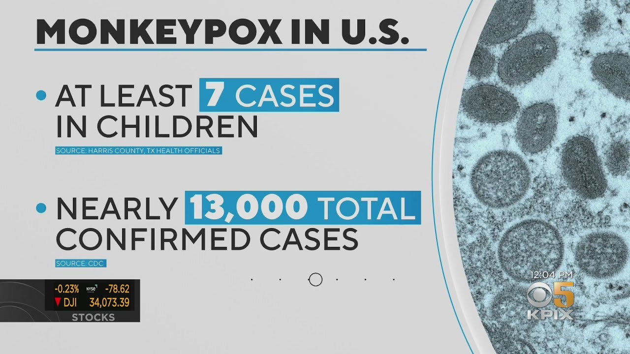 Monkeypox Update: Who Warning On Pets; New Rapid Test; Sf Clinic Closes;