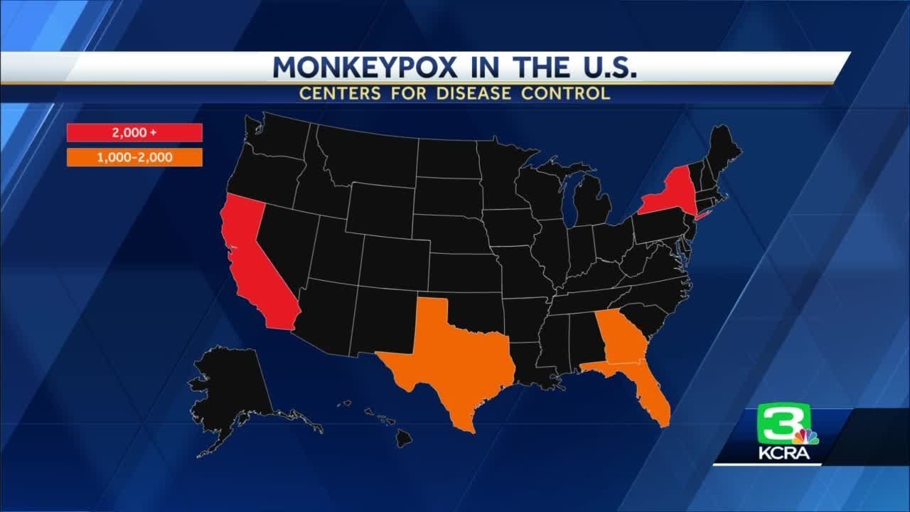 Mpx, Monkeypox Update 8/19/22