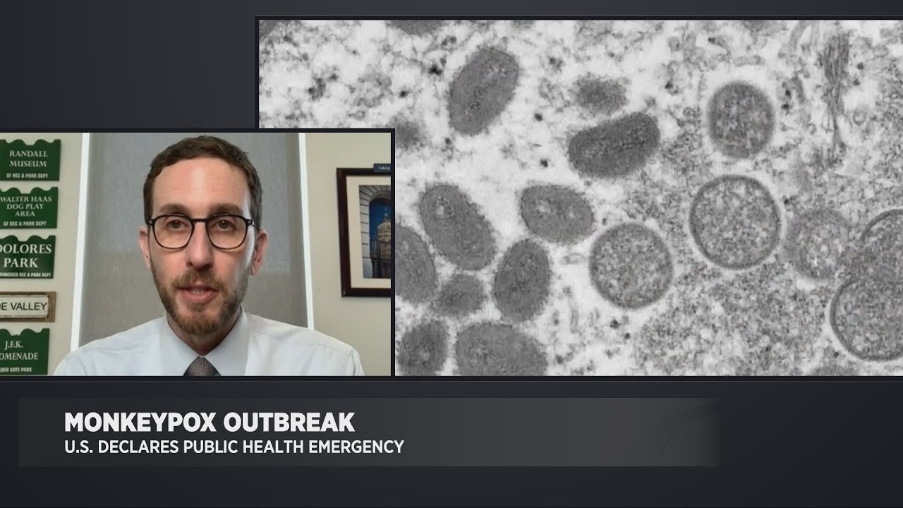 Sen. Scott Wiener Discusses Monkeypox Emergency