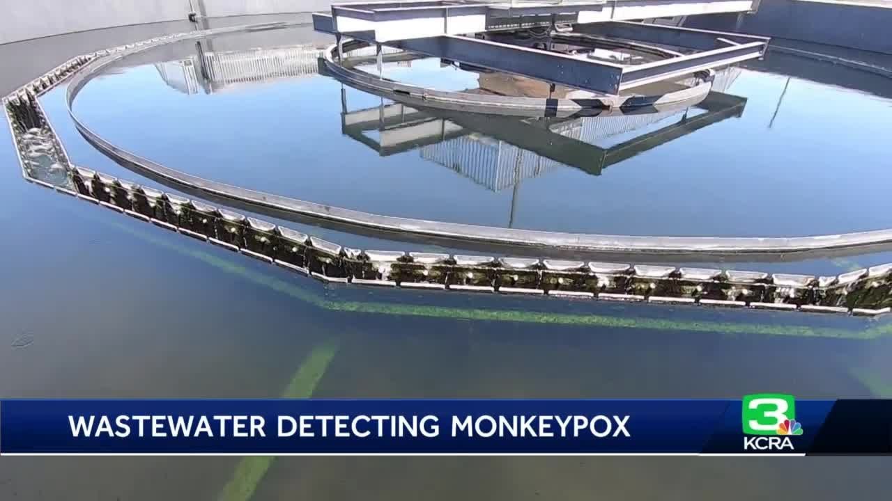 Sewage Water In 11 California Locations Being Tested To Detect Monkeypox