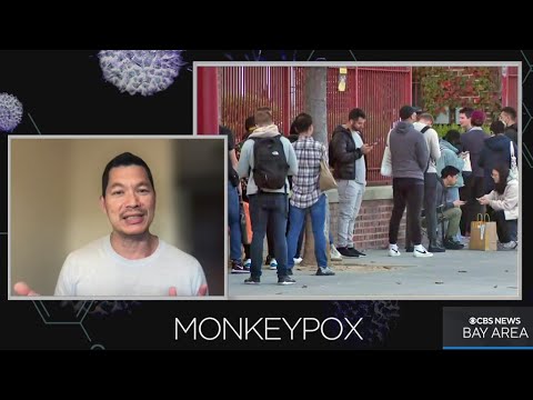 Talking Monkeypox: Dr. Peter Chin Hong