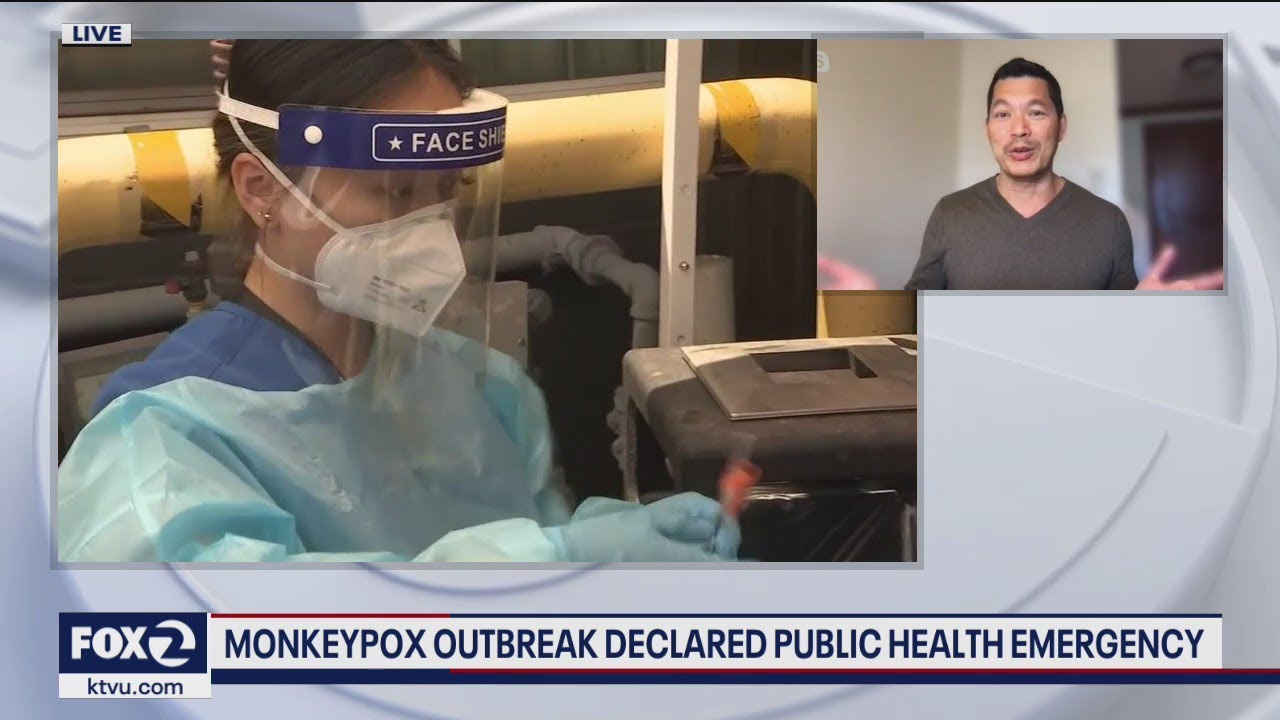 Us Declares Monkeypox Outbreak A Public Health Emergency