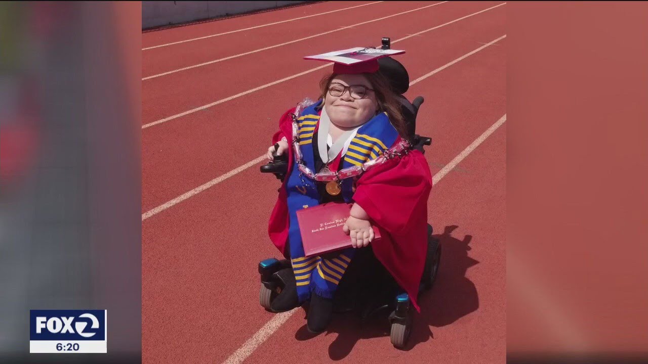 Bay Area Taylor Swift Fan With Rare Genetic Disease Seeks Ada Seat For South Bay Concert