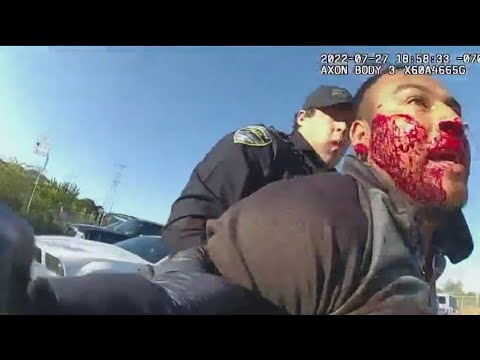 Marin County DA charges vs. San Rafael officers with assault in bloody arrest of day laborer 1 Marin County Da Charges Vs. San Rafael Officers With Assault In Bloody Arrest Of Day Laborer