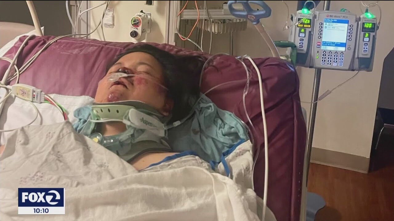 Vallejo Residents Express Concern Over Traffic Intersection After Accident