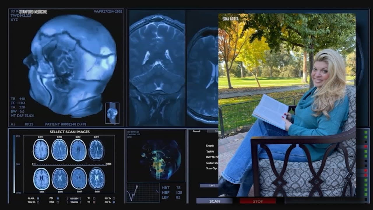 Stanford's brain implant helps woman regain cognitive function 1 Stanford’s Brain Implant Helps Woman Regain Cognitive Function