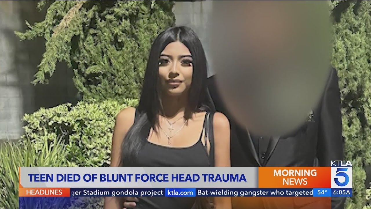 los angeles student died of acci