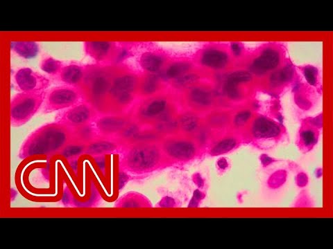 tumors just vanished cancer pati