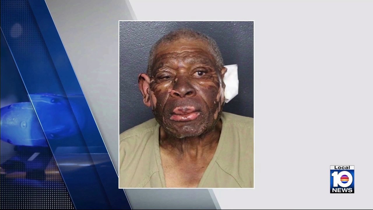 84-year-old Man Arrested For Setting Car On Fire With Woman Inside